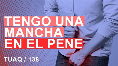 manchas en el pen negras|Manchas en el pene: causas y qué hacer